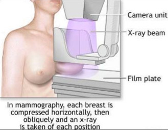 mamografia-malaga